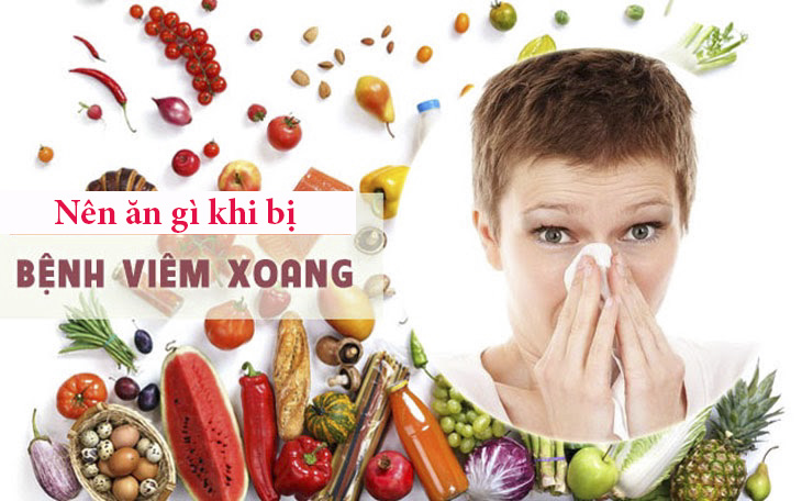 Viêm Xoang Sàng Nên Ăn Gì Và Không Nên Ăn Gì