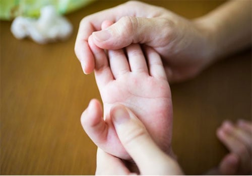 TRẺ BỊ HO BẤM HUYỆT NÀO MỚI ĐEM LẠI HIỆU QUẢ?