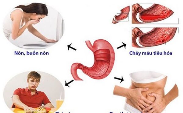 Xóa tan nỗi khổ cho người đau dạ dày bằng Nano Curcumin cải tiến