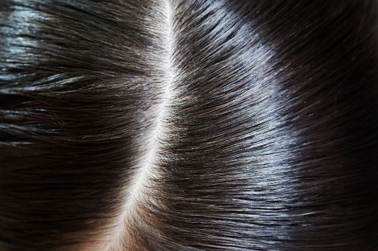 Monolaurin có vai trò gì trong trị rụng tóc?