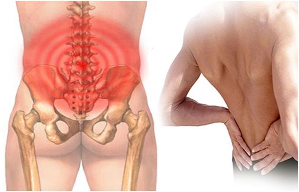 Nguyên nhân của bệnh đau lưng thường xuyên.