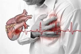 Tìm hiểu về đau tim và suy tim.