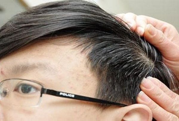 Viên uống trị tóc bạc sớm Anti Gray Hair 7050 của Mỹ giá tốt
