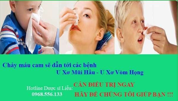 THẢO DƯỢC ĐIỀU TRỊ TRIỆT ĐỂ BỆNH “NÓNG TRONG NGƯỜI” - CHẢY MÁU CAM HIỆU QUẢ