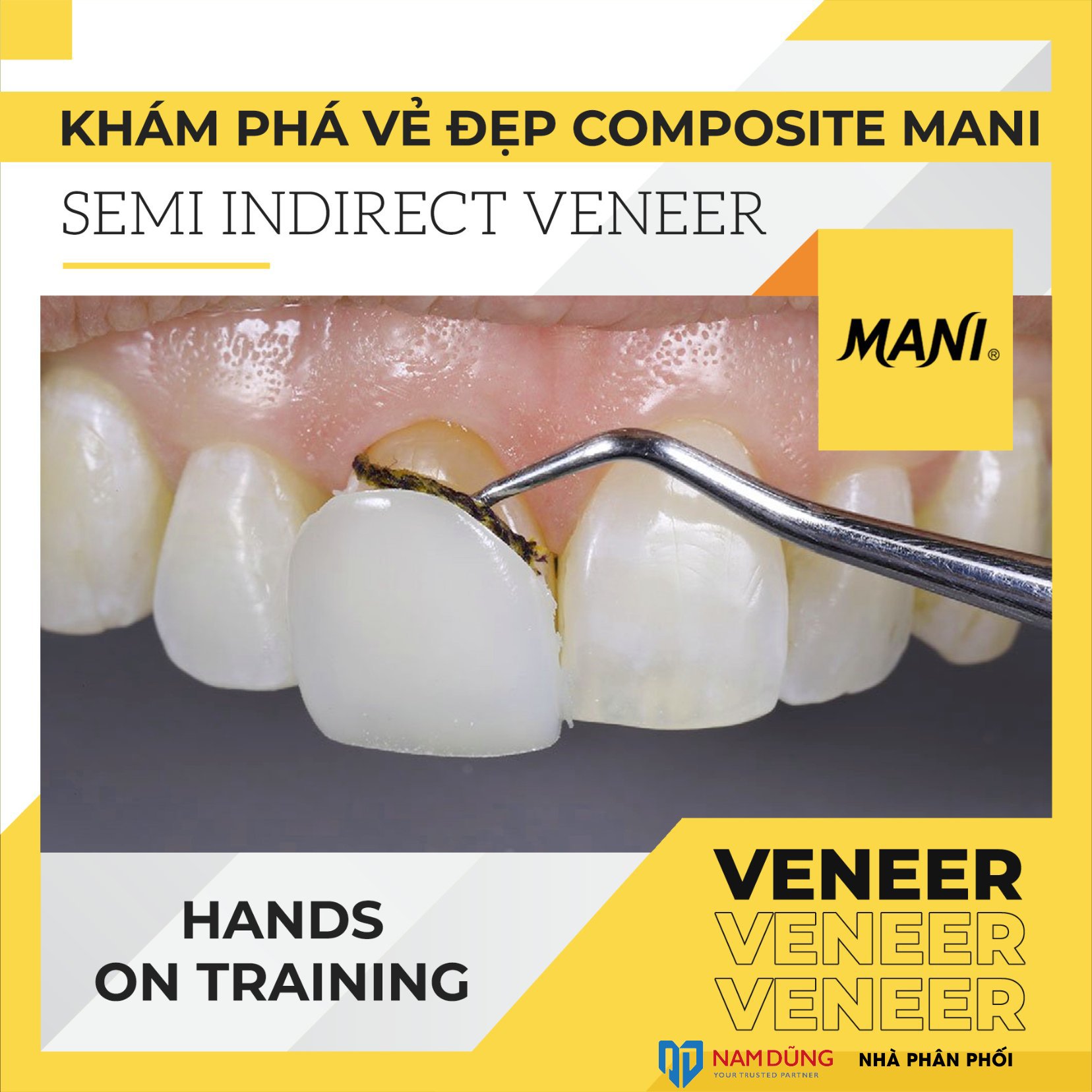 KHÓA HỌC 3/12 HN: KHÁM PHÁ VẺ ĐẸP COMPOSITE MANI-SEMI INDIRECT VENEER