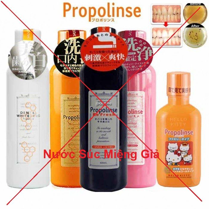 Giật mình nước súc miệng Propolinse giả bán tràn lan trên mạng chỉ 139k