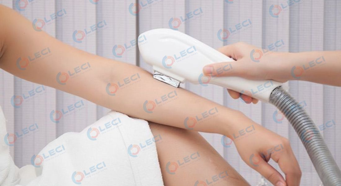 Sửa máy IPL tại TP Hồ Chí Minh nhanh chóng