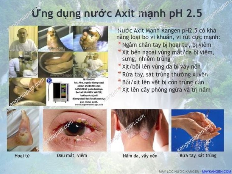 Máy Lọc Nước Kangen Leveluk SD501 Platinum 100% Chính Hãng Nhật Bản