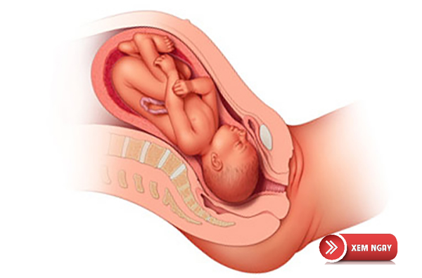  Tử cung mở 2cm bao lâu thì sinh ? Tất cả những gì bạn cần biết