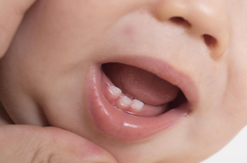 Trẻ mọc răng chậm nguyên nhân do đâu - Khi nào cần lo lắng?