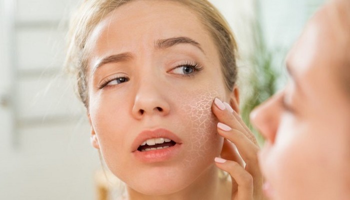 Bề mặt da khô thường bị bong tróc và xỉn màu hơn so với da dầu hay da thường