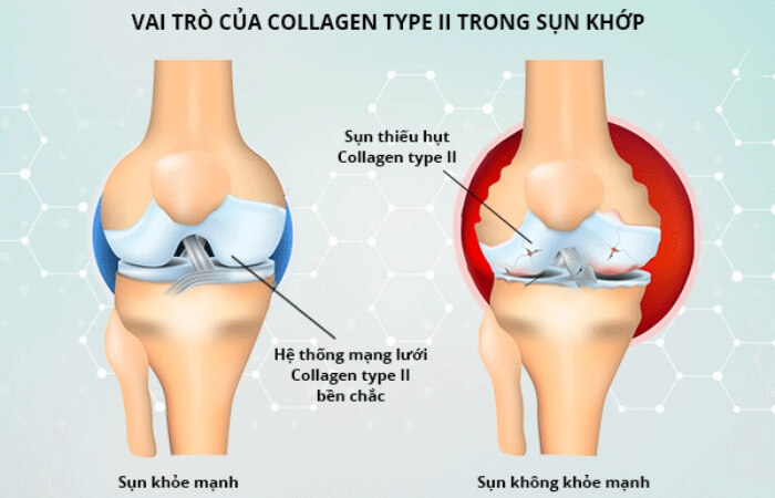 Collagen bảo vệ xương khớp khỏe mạnh, giảm khả năng bị viêm khớp