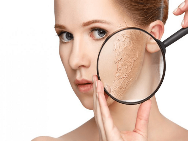 Da khô nhạy cảm và dễ bị lão hóa sớm nếu không chăm sóc kỹ