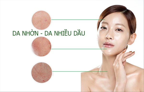 chăm sóc da nhờn