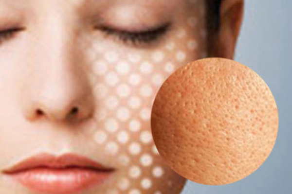 kết hợp sữa rửa mặt se khít lỗ chân lông chăm sóc da
