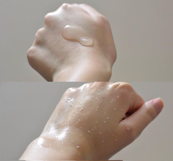 Da nhạy cảm nên dạng peeling
