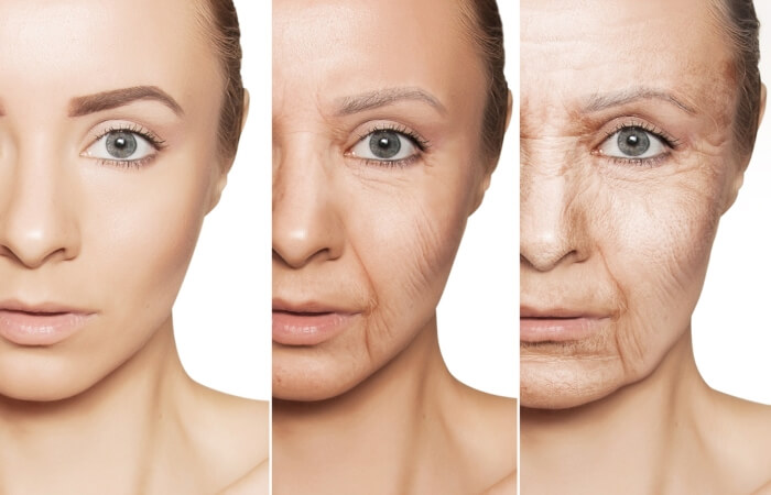 Bước qua độ tuổi 30 trở về sau, tiến trình lão hóa diễn ra nhanh chóng với lượng collagen thất thoát ngày càng nhiều