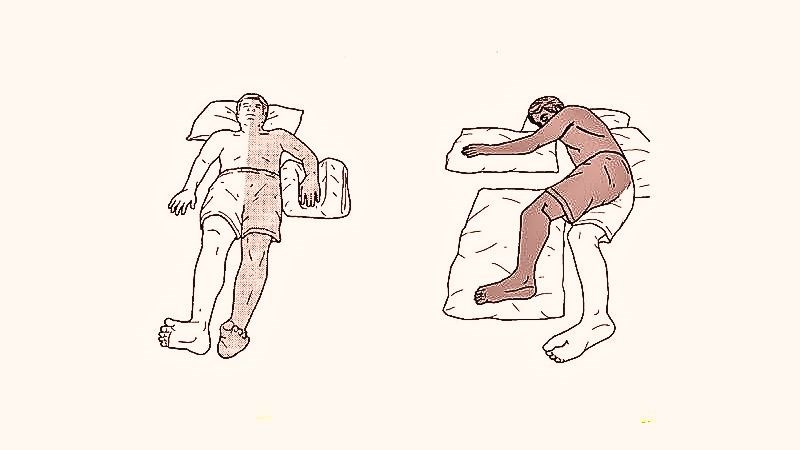 Di chứng liệt nửa người: Các phương pháp điều trị với y học cổ truyền.