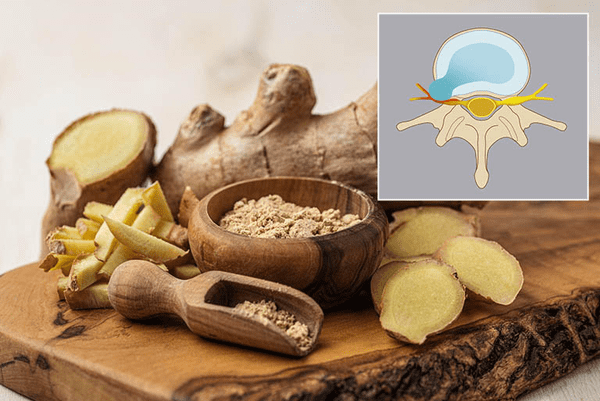 Các phương pháp dùng gừng chữa thoát vị đĩa đệm