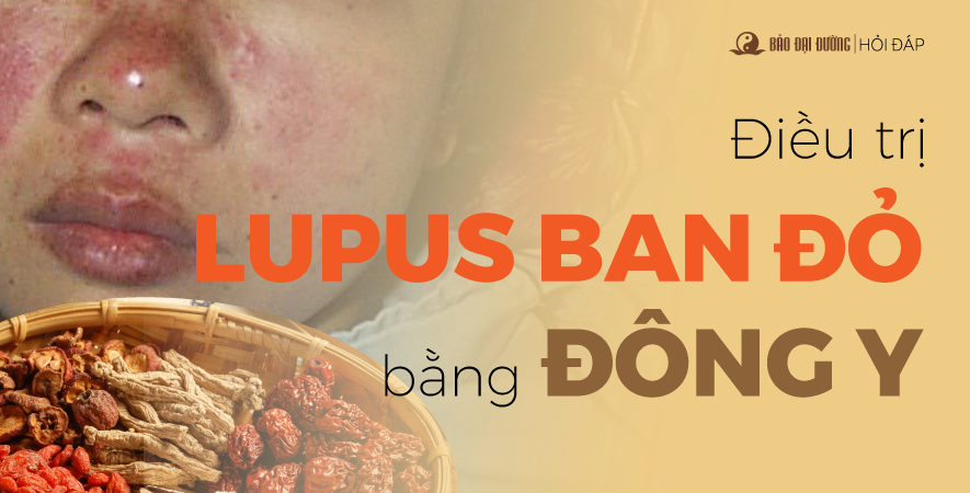 ĐIỀU TRỊ LUPUS BAN ĐỎ BẰNG ĐÔNG Y?