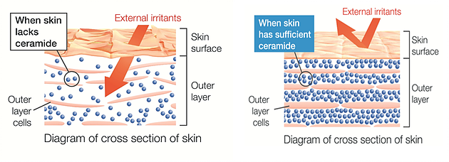 Sự khác biệt của da khi thiếu Ceramide (trái) và da được cung cấp đầy đủ Ceramide (phải)