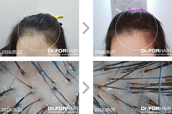 review-dau-goi-dr-forhair-hebecare