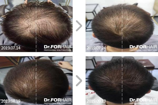 review-dau-goi-dr-forhair-hebecare