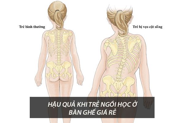 Hình ảnh bài viết