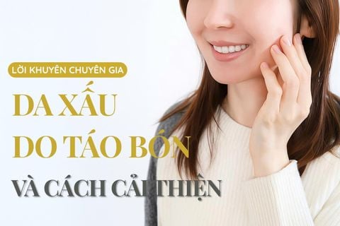3 LÝ DO KHIẾN TÁO BÓN GÂY MỤN VÀ 5 CÁCH CẢI THIỆN