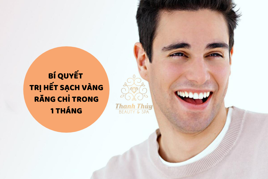 Bí quyết trị hết sạch vàng răng chỉ trong 1 tháng