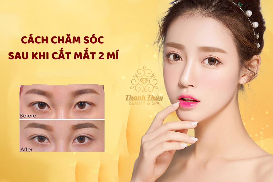 CÁCH CHĂM SÓC SAU KHI CẮT MẮT 2 MÍ
