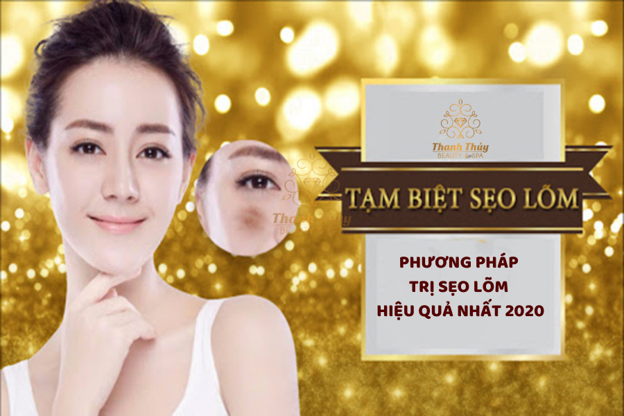 Phương Pháp Trị Sẹo Lõm Hiệu Quả Nhất 2020