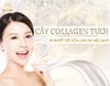 Cấy Collagen Tươi - Bí Quyết Trẻ Hóa Làn Da Hiệu Quả