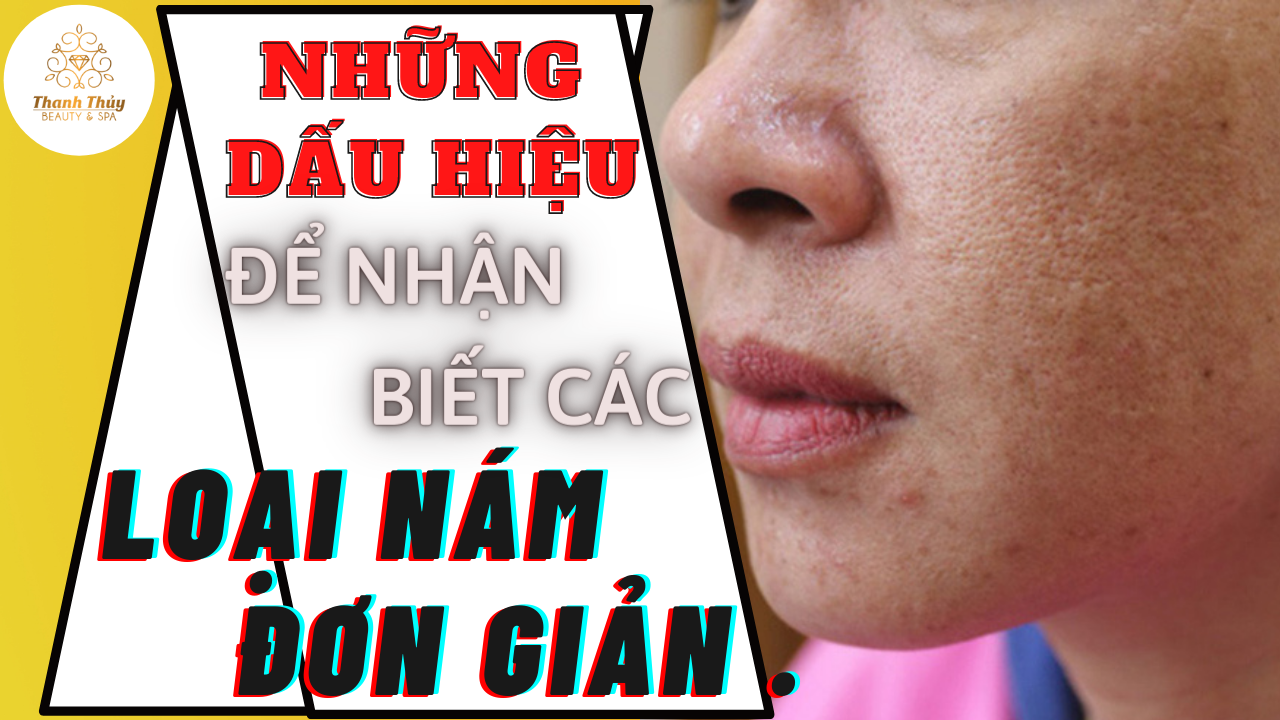 Những dấu hiệu để nhận biết các loại nám đơn giản .