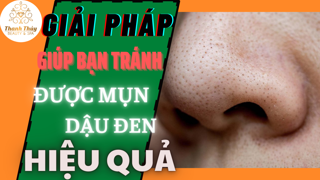 Giải pháp giúp bạn tránh được mụn đậu đen hiệu quả.