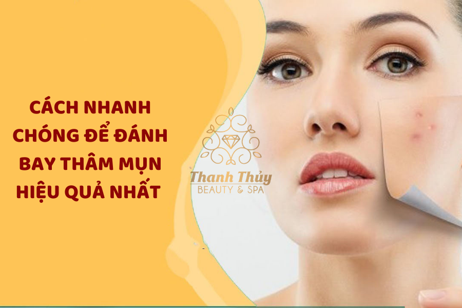 ​​​​​​​CÁCH NHANH CHÓNG ĐỂ ĐÁNH BAY THÂM MỤN HIỆU QUẢ NHẤT