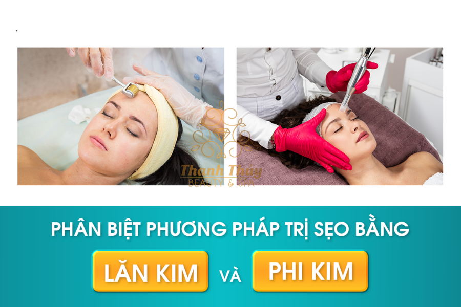 HIỂU RÕ VỀ PHI KIM/ LĂN KIM CHO NGƯỜI MỚI HỌC