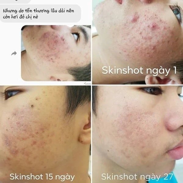 Công Dụng tuyệt vơi của Skin Shot Cho làn da