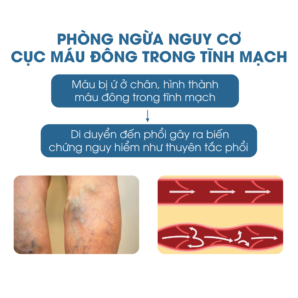 Lý do nên dùng gối kê chân khi ngủ