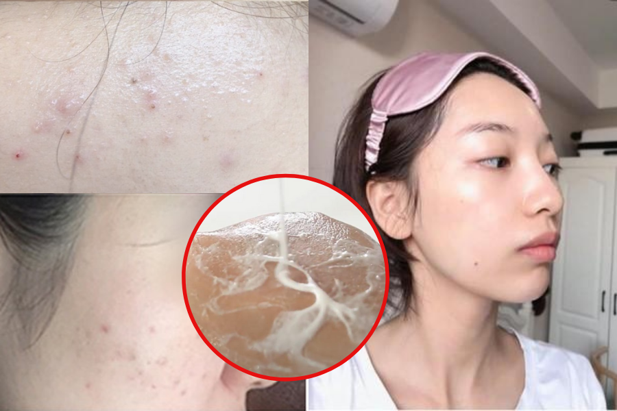 Làm sạch da không đúng cách, 