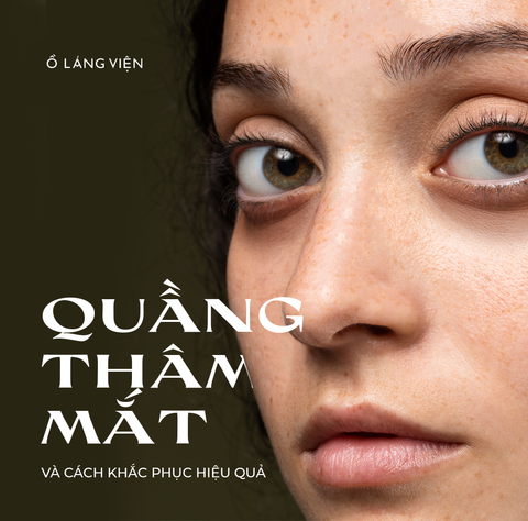QUẦNG THÂM MẮT VÀ CÁCH KHẮC PHỤC HIỆU QUẢ VỚI GIẢI PHÁP TIÊM/THERMAGE