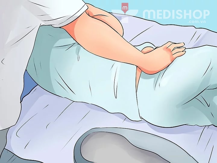 cách đặt bô nằm cho người bệnh
