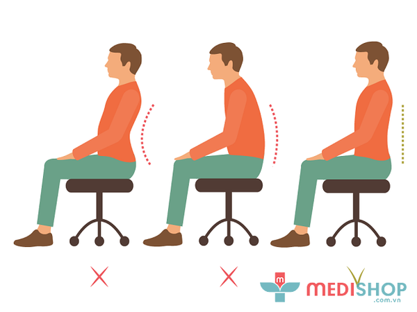 Gù lưng có thể do thói quen ngồi và đi lại sai cách