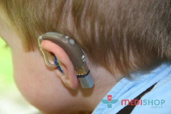 Tùy thuộc vào nhu cầu để lựa chọn máy trợ thính sao cho phù hợp.