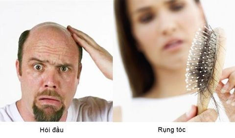 Top 10 nguyên nhân gây rụng tóc đang “ngầm” phá hoại mái tóc của bạn