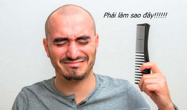 7 mẹo chữa hói đầu “mất tiền, hại sức khỏe” bạn tuyệt đối không nên làm theo.