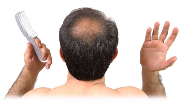 Hành trình tìm kiếm thuốc trị rụng tóc tốt nhất hiện nay