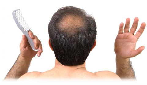 Hành trình tìm kiếm thuốc trị rụng tóc tốt nhất hiện nay