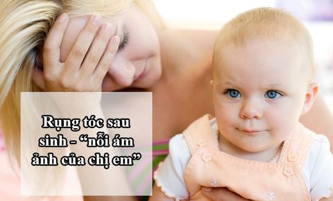 Thuốc trị rụng tóc sau sinh – chống tóc rụng hiệu quả sau khi sinh!