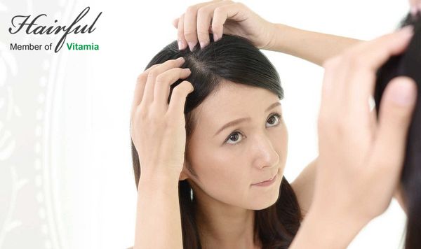 Thuốc giảm rụng tóc nào tốt nhất – hiệu quả nhất hiện nay!